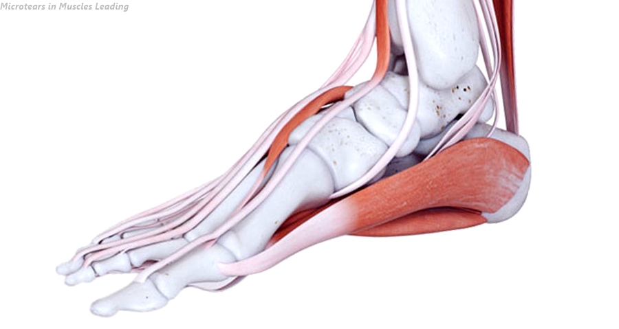 Microtears in Muscles Leading